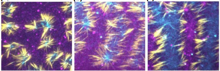 Illustrative picture of microtubules